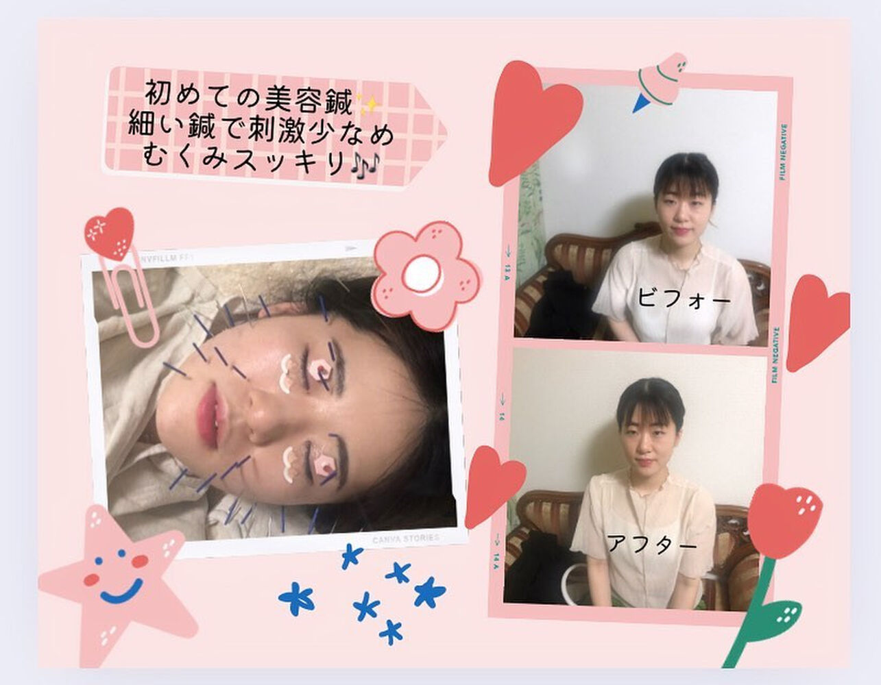 ブログ