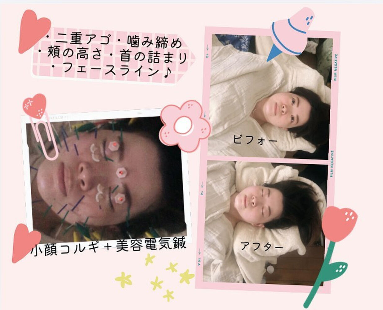 ブログ